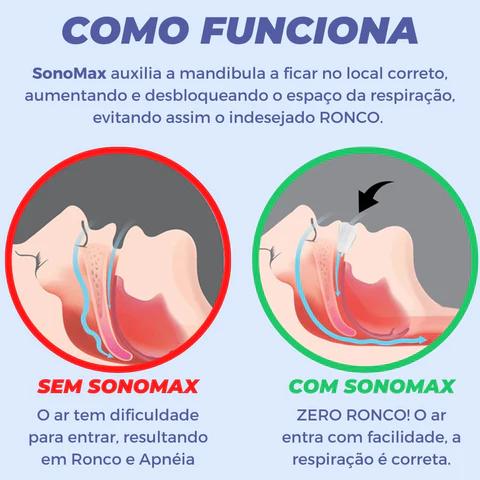 SonoPRO - Aparelho Anti Ronco, Bruxismo e Apnéia com Resultados Imediatos